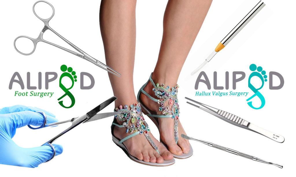 Chirurgia Estetica Dei Piedi Podochirurgia